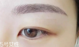 激光洗眉恢復(fù)期有疤痕怎么辦？激光洗眉毛之后正確護(hù)理方法