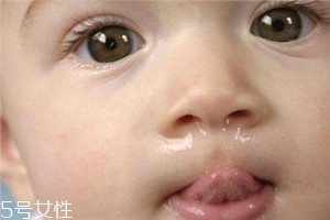 冬季寶寶流鼻涕是什么原因？教你幾招輕松應(yīng)對