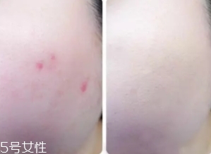 cpb遮瑕棒怎么樣？來看看使用效果