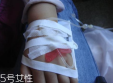 輸液治療不適合哪些??？過敏反應危害大