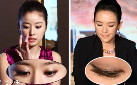 內(nèi)雙怎么進(jìn)化成雙眼皮？全是雙眼皮貼的功勞