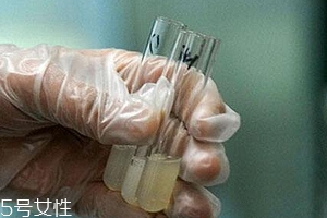 捐精有什么危害？專(zhuān)家稱(chēng)沒(méi)有危害