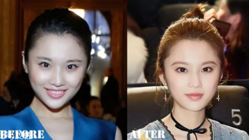 瑯琊榜2張慧雯整容了嗎？換了妝發(fā)美到不認(rèn)識(shí)