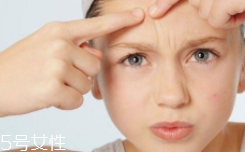 痘痘肌該怎么化妝？這樣化才利于肌膚恢復(fù)