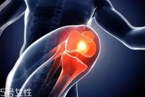 關(guān)節(jié)有響聲是病嗎？兩種情況區(qū)別對(duì)待