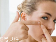 肌膚需要排毒嗎？長痘并不代表排毒