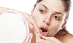 肌膚需要排毒嗎？長痘并不代表排毒
