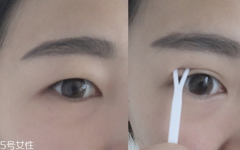 雙眼皮貼一般多少錢？