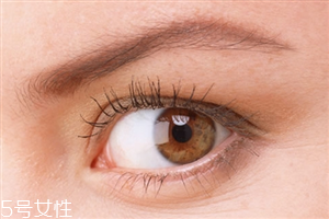 開眼角會(huì)影響視力嗎？開眼角會(huì)有危害