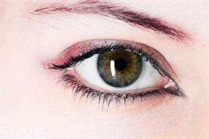 開(kāi)眼角有什么風(fēng)險(xiǎn)？開(kāi)眼角并不適合所有人