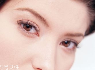 割雙眼皮后怎么卸妝？割雙眼皮的人群適宜