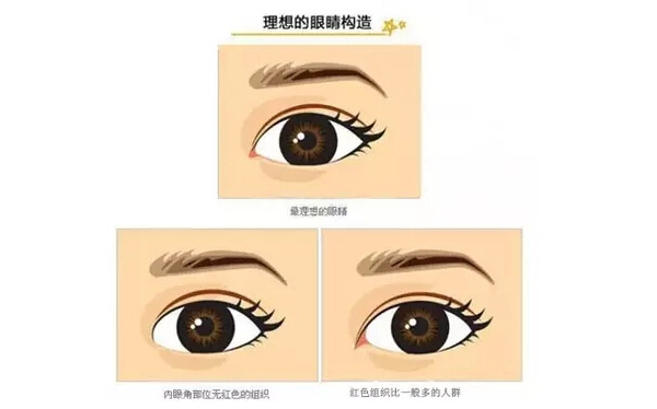 開外眼角和開內(nèi)眼角哪個(gè)好？開眼角有可能會(huì)回縮
