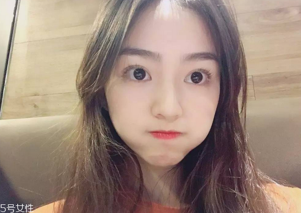 割雙眼皮要注意什么？割雙眼皮充血是正?，F(xiàn)象