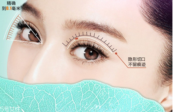 韓式雙眼皮是永久的嗎？圓眼睛不適合做雙眼皮