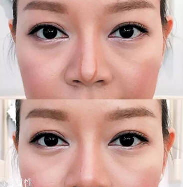 眉粉可以當(dāng)鼻影用嗎？眉粉這樣畫鼻影