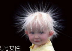 少年白什么原因？焦慮緊張會得病