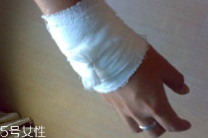 被蜈蚣咬傷后能治愈嗎？科學(xué)家有新發(fā)現(xiàn)