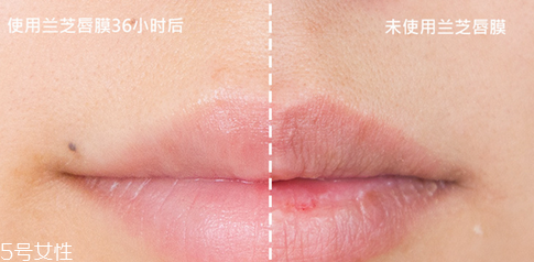 蘭芝唇膜吃進去怎么辦？擁有水嫩嘴唇