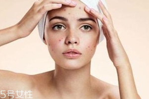 痘痘反復(fù)長是什么原因？基礎(chǔ)護膚不夠用心