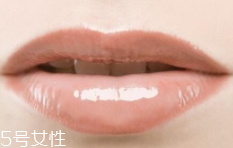 嘴唇干裂是一種病嗎？治療口角炎從改善習(xí)慣入手