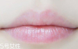 嘴唇干裂是一種病嗎？治療口角炎從改善習(xí)慣入手