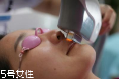 科技脫毛有哪些種類？冰點(diǎn)脫毛不毀毛囊