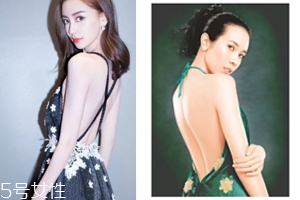 怎樣矯正背溝缺失？減肥運(yùn)動(dòng)是關(guān)鍵