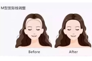 發(fā)際線粉填充和發(fā)際線筆哪個(gè)好？配合使用才最完美