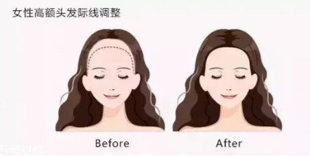 發(fā)際線粉填充和發(fā)際線筆哪個好？配合使用才最完美