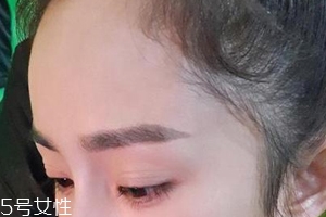 發(fā)際線高怎么治？拯救發(fā)際線攻略
