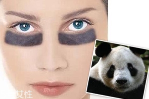 黑眼圈很重是什么原因？深扒三類黑眼圈的成因