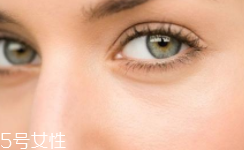 黑眼圈很重是什么原因？深扒三類黑眼圈的成因