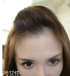 什么女孩適合不留劉海？圓臉妹子掀起劉海更適合你