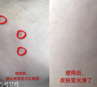 資生堂紅腰子適合什么年齡？最適合30歲以下人群