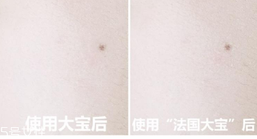 范爺同款法國(guó)大寶Embryolisse和大寶SOD蜜哪個(gè)好用？