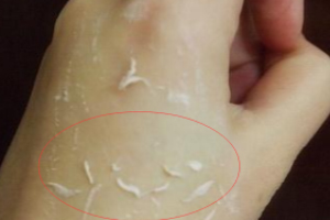 去角質凝露多久用一次？皮厚一周一次
