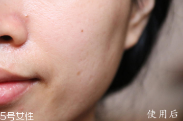 悅木之源和伊麗莎白雅頓哪個(gè)好？?jī)煽罹A大比拼