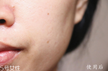 悅木之源和伊麗莎白雅頓哪個(gè)好？?jī)煽罹A大比拼