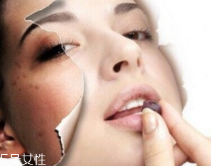 春季如何預(yù)防皮膚過(guò)敏？選擇敏感肌專用護(hù)膚品