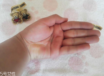 柳屋生發(fā)水有用嗎？一個月后長出新發(fā)