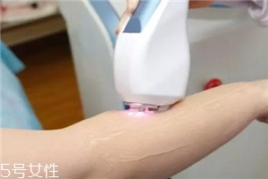 脫毛儀可以脫發(fā)際線嗎？脫了還會再長