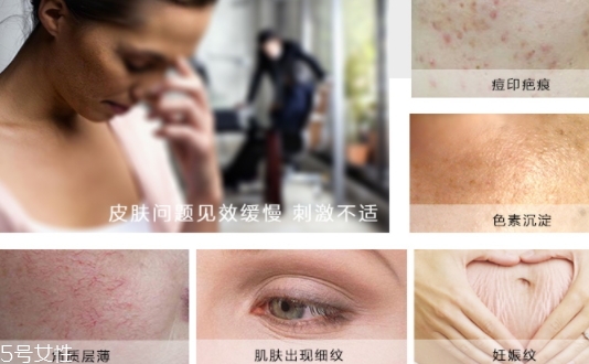 德國(guó)krauterhof蝸牛精華膏效果怎么樣？