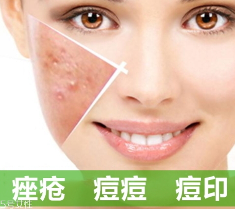 a酸是什么？a酸的功效與副作用