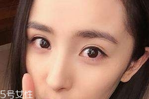 葉黃素能治療夜盲癥嗎？看什么類型的