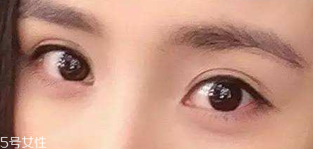 葉黃素能治療夜盲癥嗎？看什么類型的