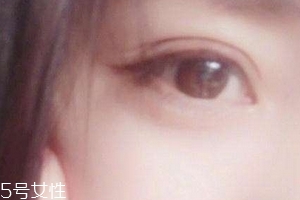 葉黃素一天吃多少毫克？按說明服用