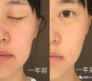 童顏機(jī)有用嗎？童顏機(jī)的功效