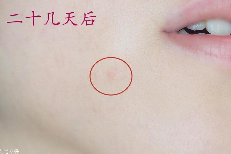 雅詩(shī)蘭黛晶透沁白防曬搖搖乳成膜快嗎？適合油痘皮嗎？