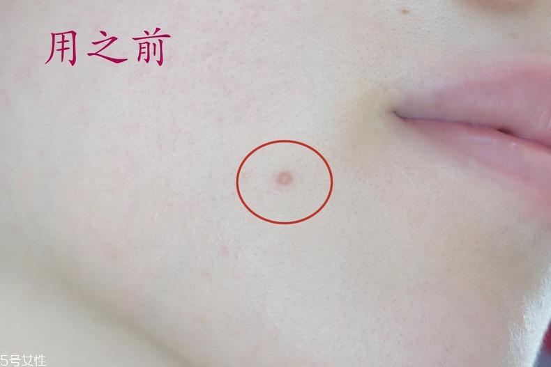 雅詩(shī)蘭黛晶透沁白防曬搖搖乳成膜快嗎？適合油痘皮嗎？