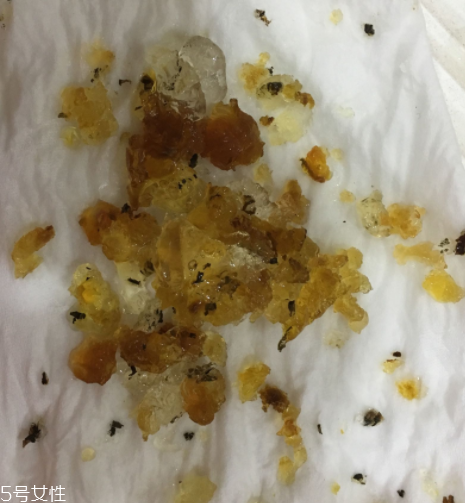 桃膠能和雞蛋一起吃嗎？桃膠配雞蛋可以嗎？